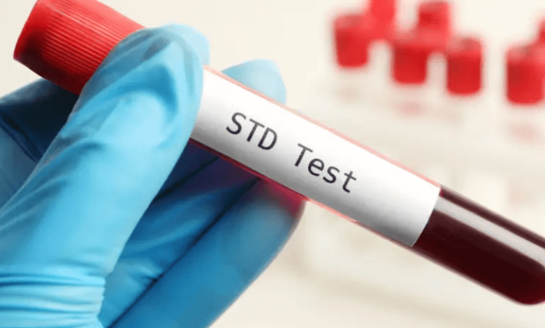 Why an STD Test Dubai Should Be Part of Your Annual Health Checkup